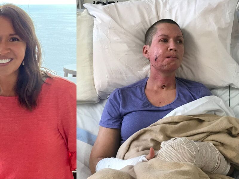 loriwalkerbeforeandafter.jpg