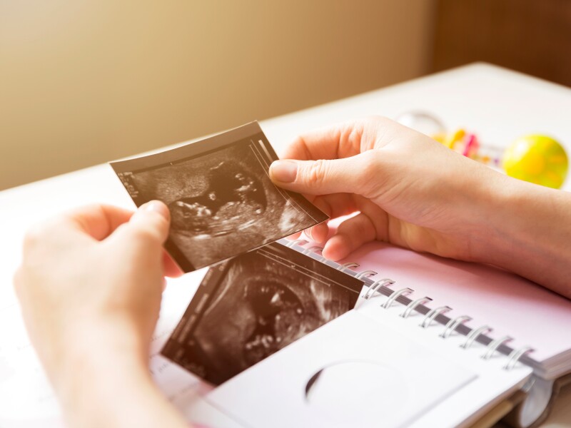Woman,Placing,Baby's,Sonogram,Into,Baby's,First,Year,Memory,Book