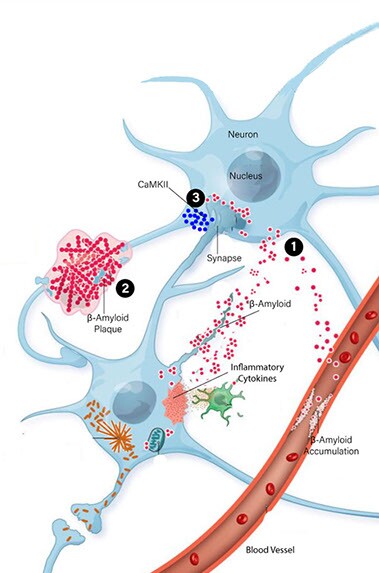 memnivia-neuron-chart.jpg